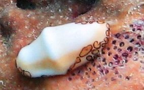 Flamingo Tongue - Cyphoma gibbosum